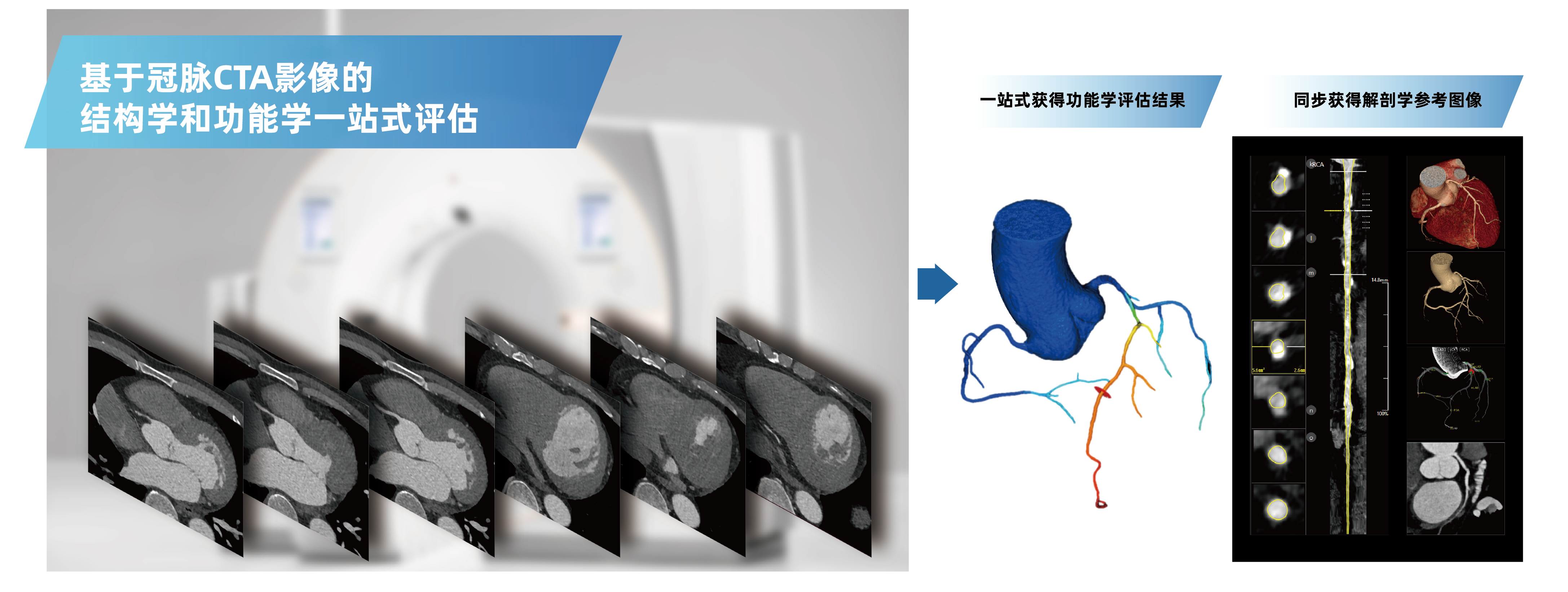 博动医疗科技—技术赋能医学，守护生命健康- 博动医疗科技