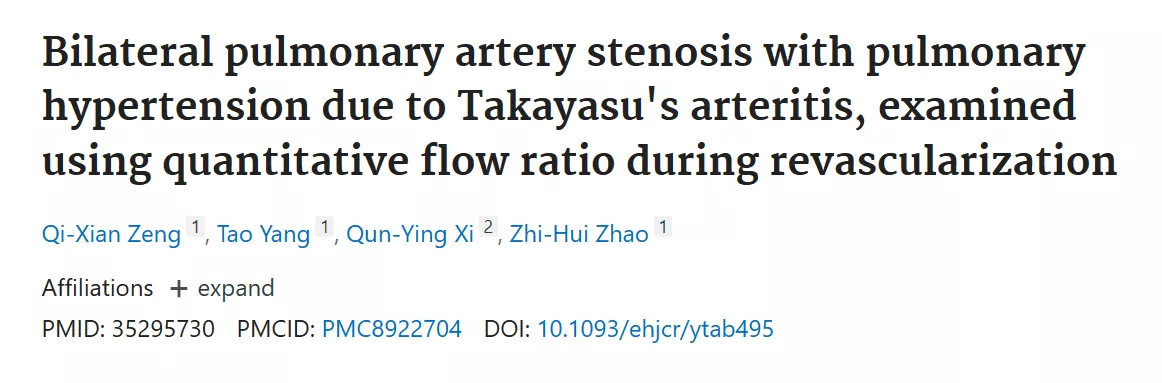 Bilateral pulmonary artery stenosis with pulmonary hypertension due to Takayasu's arteritis, examined using quantitative flow ratio during revascularization
